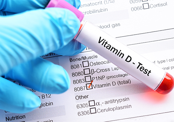 Spetsiaalne D-vitamiini diagnostika tööriist